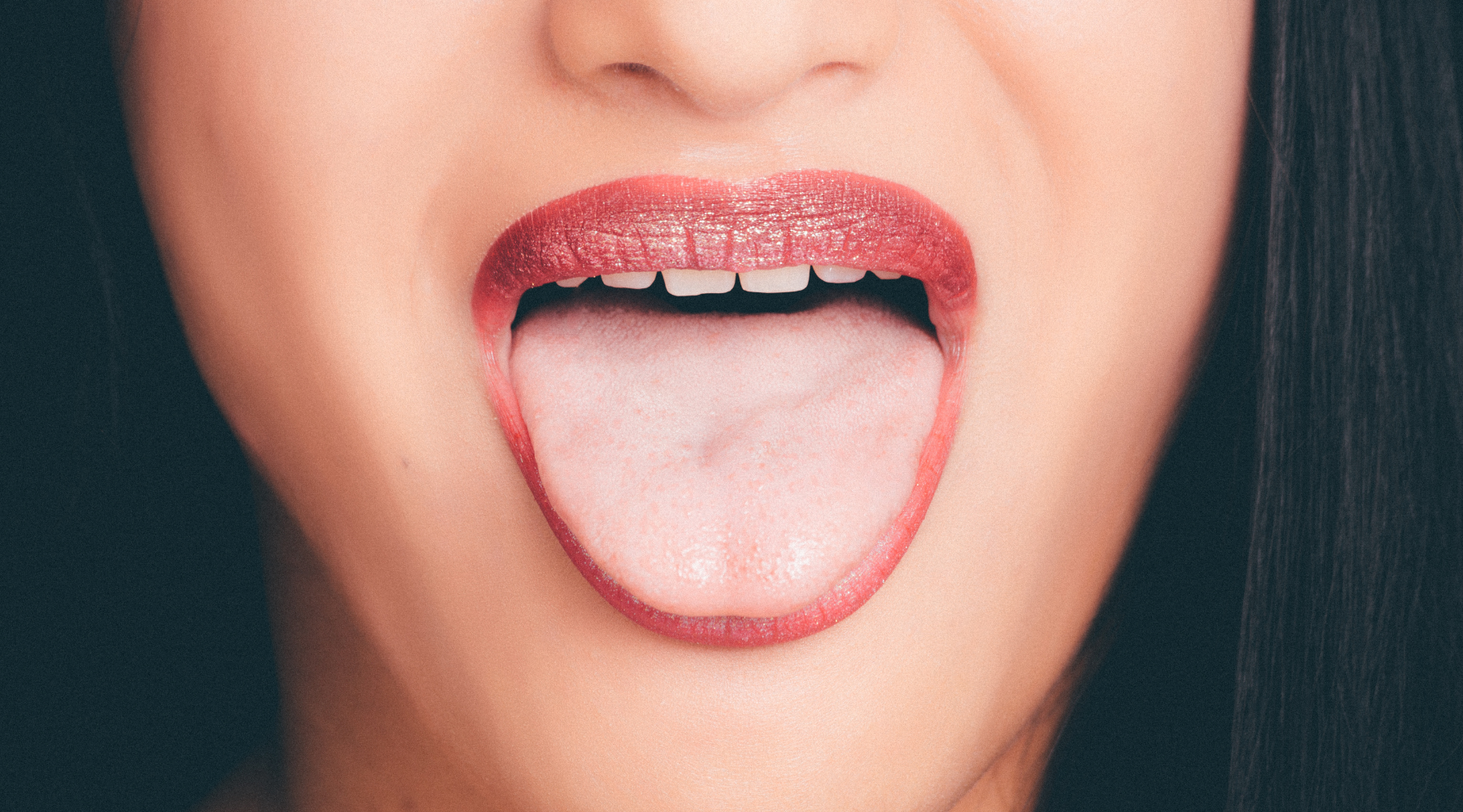 Burning mouth syndrome: How Histamine and Mast Cell Activation Syndrome could be the cause